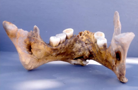 Археологи нашли останки византийского воина с «золотой» челюстью