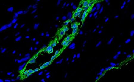 Найден новый вид стволовых клеток 