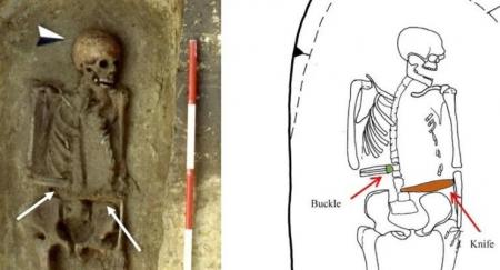 В средневековом захоронении нашли мужчину с ножом вместо руки